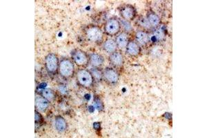 Immunohistochemical analysis of SAPK2 staining in rat brain  formalin fixed paraffin embedded tissue section. (MAPK11 anticorps)