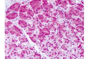 Anti-PRKD2 antibody IHC of human stomach.