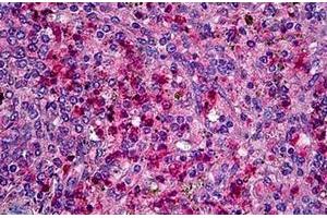 Formalin-Fixed, Paraffin-Embedded tissue stained with CCR1 Antibody  at 5 µg/ml after heat-induced antigen retrieval.