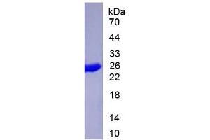 SDS-PAGE of Protein Standard from the Kit (Highly purified E. (Cytokeratin 19 Kit ELISA)