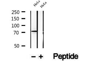 Western blot analysis of extracts of HeLa cells, using TBC1D23 antibody. (TBC1D23 anticorps  (Internal Region))