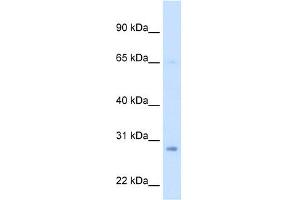 WB Suggested Anti-ECHS1 Antibody Titration:  2. (ECHS1 anticorps  (Middle Region))