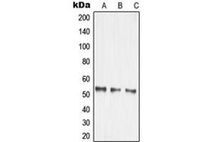 Western blot analysis of MMP14 expression in HEK293T (A), mouse kidney (B), rat brain (C) whole cell lysates. (MMP14 anticorps  (Center))