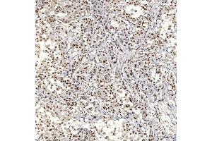 IHC analysis of U1A/SNRPA using anti-U1A/SNRPA antibody (ABIN7600891). (SNRPA1 anticorps  (AA 25-218))