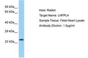Image no. 1 for anti-Lipoma HMGIC Fusion Partner-Like 4 (LHFPL4) (AA 137-186) antibody (ABIN6750211)