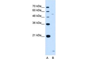 Western Blotting (WB) image for anti-ST3 beta-Galactoside alpha-2,3-Sialyltransferase 5 (ST3GAL5) antibody (ABIN2462977) (ST3GAL5 anticorps)