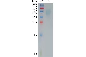 Human CD200R1 Protein, His Tag on SDS-PAGE under reducing condition.