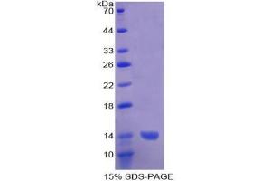 SDS-PAGE analysis of Human ADAMTS1 Protein.