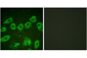Immunofluorescence (IF) image for anti-Tyrosine Hydroxylase (TH) (AA 10-59) antibody (ABIN2888583) (Tyrosine Hydroxylase anticorps  (AA 10-59))