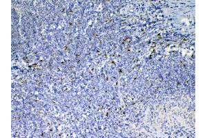 IHC analysis of IL33 using anti-IL33 antibody .