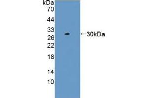 Western blot analysis of recombinant Human LACTb. (LACTB anticorps  (AA 313-547))