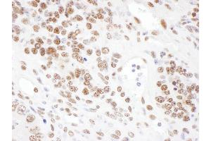 Immunohistochemistry (IHC) image for anti-Serrate RNA Effector Molecule Homolog (SRRT) (AA 826-876) antibody (ABIN7453421)