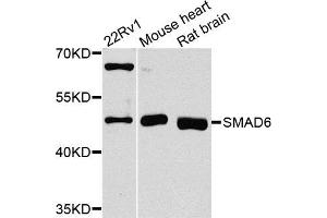 Western blot analysis of extracts of various cell lines, using SMAD6 antibody (ABIN5970214) at 1/1000 dilution. (SMAD6 anticorps)