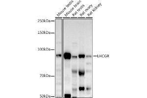 Western blot analysis of extracts of various cell lines, using LHCGR antibody (ABIN6128180, ABIN6143185, ABIN6143186 and ABIN6221866) at 1:500 dilution.