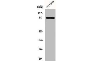 Western Blot analysis of COLO205 cells using Fyb Polyclonal Antibody (FYB anticorps  (C-Term))