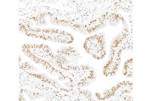 Immunohistochemistry (IHC) image for anti-Androgen Receptor (AR) (AA 1-50) antibody (ABIN7795784)