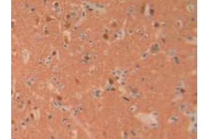 IHC-P analysis of Human Brain Tissue, with DAB staining. (UCHL1 anticorps  (C-Term))