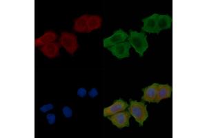 ABIN6262231 and ABIN6279482 staining Hela cells(30 min of UV treatment) by IF/ICC. (HGFA anticorps  (C-Term))