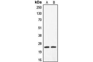 Western blot analysis of Claudin 2 expression in HeLa (A), A431 (B) whole cell lysates. (Claudin 2 anticorps  (C-Term))