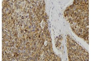 ABIN6277085 at 1/100 staining Human pancreas tissue by IHC-P. (REG3A anticorps  (Internal Region))