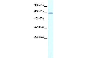 WB Suggested Anti-ZNF543 Antibody Titration:  0. (ZNF543 anticorps  (Middle Region))
