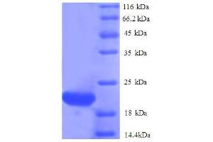 ISG15 Ubiquitin-Like Modifier (ISG15) (AA 2-157), (full length) protein (His tag)