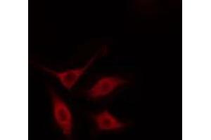 ABIN6274485 staining HeLa cells by IF/ICC. (SERINC2 anticorps  (Internal Region))