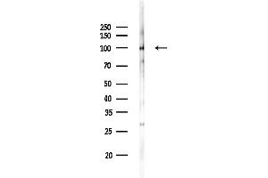 Western blot analysis of lysates from Rat brain, using DPP6 - Catalytic domain Antibody at 1/1000 dilution.
