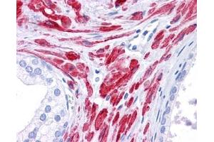 STAT5B antibody was used for immunohistochemistry at a concentration of 4-8 ug/ml.