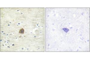 Immunohistochemical analysis of paraffin-embedded human brain tissue using CaMKII (Phospho-Thr305) antibody (left)or the same antibody preincubated with blocking peptide (right). (CAMK2A anticorps  (pThr305))