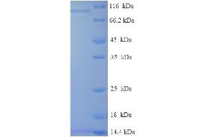 SDS-PAGE (SDS) image for V-Raf-1 Murine Leukemia Viral Oncogene Homolog 1 (RAF1) (AA 1-648), (full length) protein (His-SUMO Tag) (ABIN5710215)