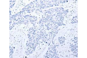 Immunohistochemistry (IHC) image for anti-Gastrin-Releasing Peptide Receptor (GRPR) antibody (ABIN1872904) (GRPR anticorps)