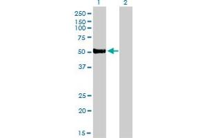 Western Blot analysis of FOXA2 expression in transfected 293T cell line by FOXA2 monoclonal antibody (M01), clone 7E6. (FOXA2 anticorps  (AA 363-457))
