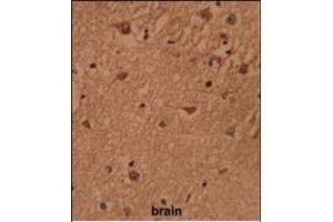 Formalin-fixed and paraffin-embedded human brain reacted with HSP Antibody (Center), which was peroxidase-conjugated to the secondary antibody, followed by DAB staining. (BRISC and BRCA1 A Complex Member 1 (BABAM1) (AA 116-143) anticorps)