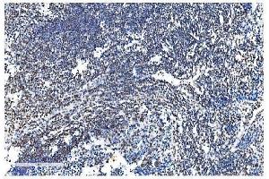 IHC analysis of NRF1 using anti-NRF1 antibody (ABIN7600874).