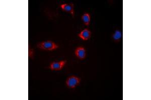 Immunofluorescent analysis of BAD (pS155) staining in Hela cells. (BAD anticorps  (C-Term, pSer155))