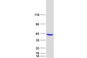 Validation with Western Blot