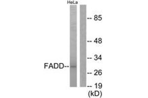 Western blot analysis of extracts from HeLa cells, treated with PMA 125ng/ml 30', using FADD (Ab-194) Antibody. (FADD anticorps  (AA 159-208))
