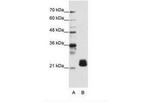 Image no. 2 for anti-Transmembrane Emp24 Protein Transport Domain Containing 4 (TMED4) (N-Term) antibody (ABIN202093) (TMED4 anticorps  (N-Term))