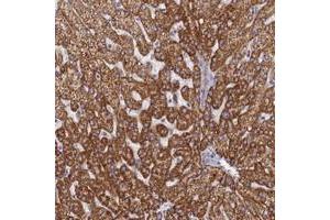 Immunohistochemical staining of human liver with TMEM30B polyclonal antibody  shows strong cytoplasmic positivity in hepatocytes at 1:50-1:200 dilution. (TMEM30B anticorps)