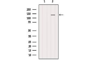 Western blot analysis of extracts from B16F10, using MN1 Antibody. (Meningioma 1 anticorps  (Internal Region))