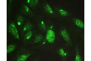 ICC testing of FFPE rat NRK cells with TCP1 delta antibody. (CCT4 anticorps)