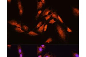 Immunofluorescence analysis of C6 cells using BTRC Polyclonal Antibody at dilution of 1:100.