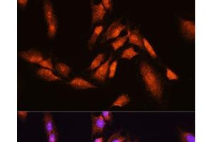 Immunofluorescence analysis of C6 cells using BTRC Polyclonal Antibody at dilution of 1:100. (BTRC anticorps)