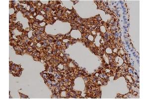 ABIN6267521 at 1/200 staining Mouse lung2. (ZAP70 anticorps  (pTyr319))