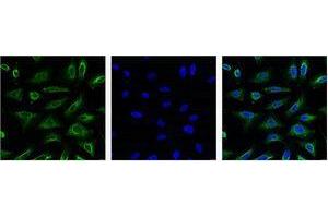 Immunofluorescence (IF) analysis of HeLa with antibody (Left) and DAPI (Right) diluted at 1:100.
