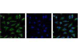Immunofluorescence (IF) analysis of HeLa with antibody (Left) and DAPI (Right) diluted at 1:100. (Aquaporin 4 anticorps)