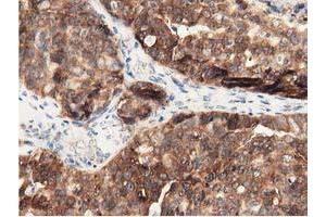 Immunohistochemistry (IHC) image for anti-DnaJ (Hsp40) Homolog, Subfamily A, Member 2 (DNAJA2) antibody (ABIN1497861) (DNAJA2 anticorps)