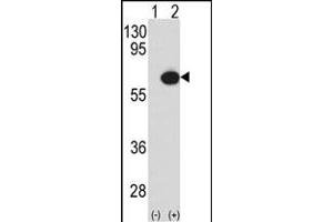 Western blot analysis of P3K7IP1 (arrow) using rabbit polyclonal P3K7IP1-p (ABIN390847 and ABIN2841073). (TAB1 anticorps  (AA 416-445))