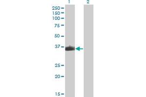 Western Blot analysis of ZNF187 expression in transfected 293T cell line by ZNF187 monoclonal antibody (M04), clone 3E11. (ZNF187 anticorps  (AA 1-325))